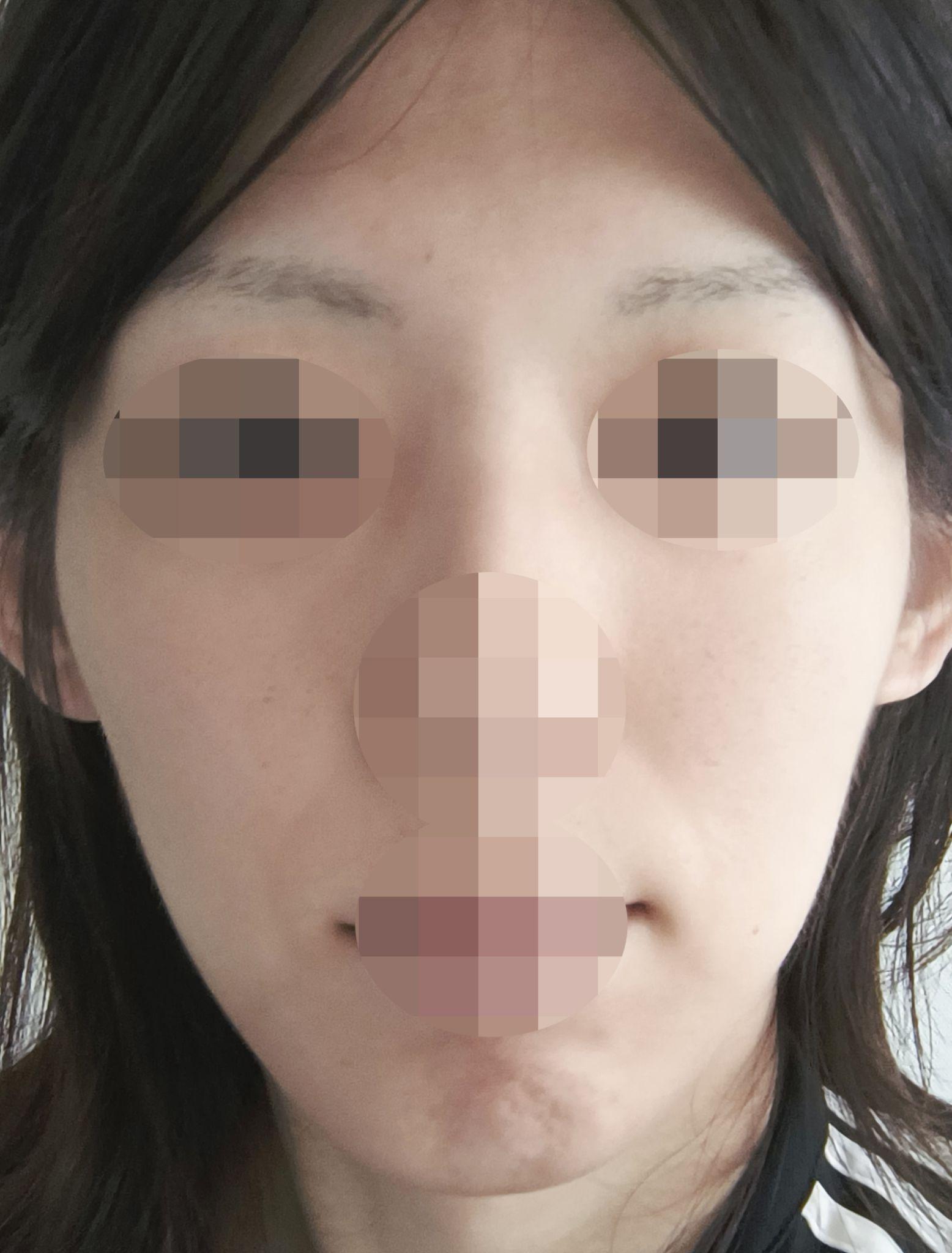 後