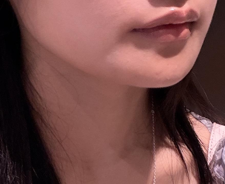 后