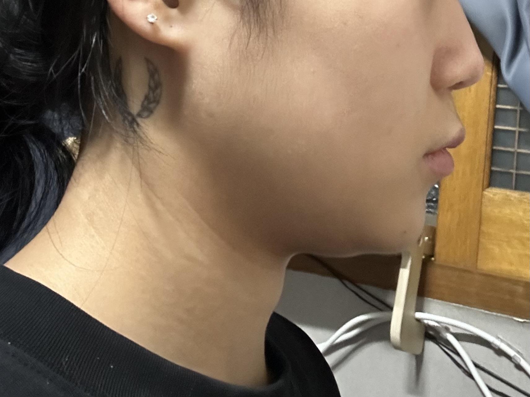 後