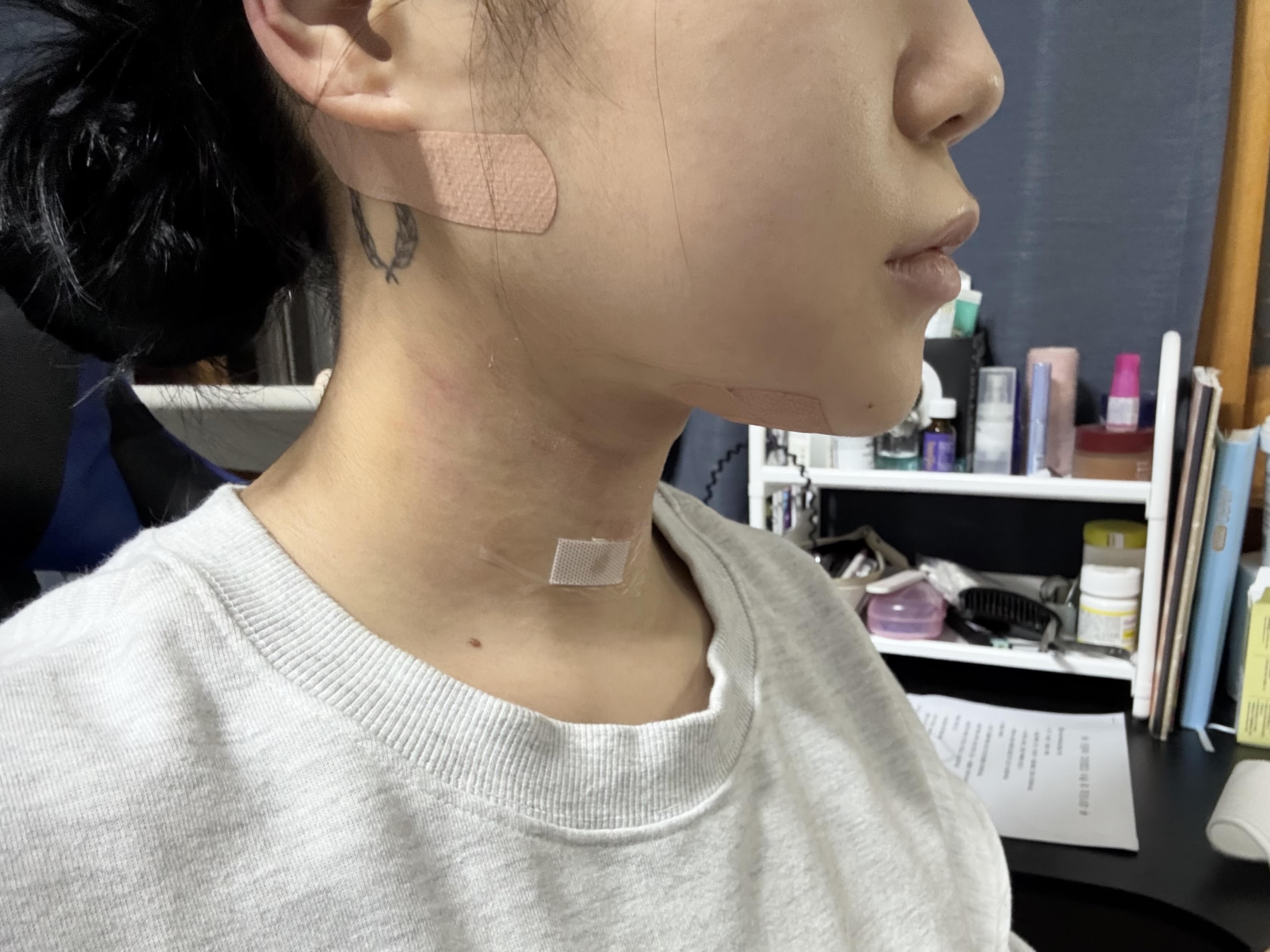 後