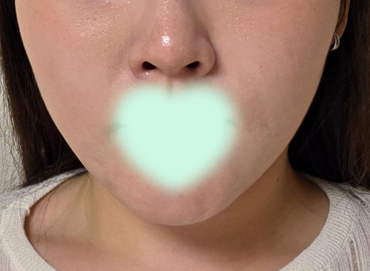 後
