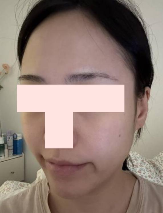 後