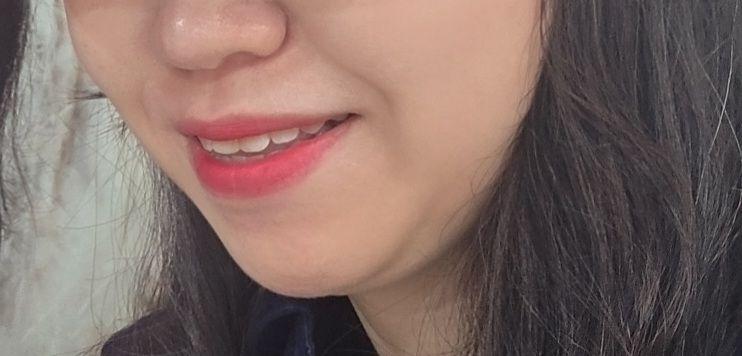 後