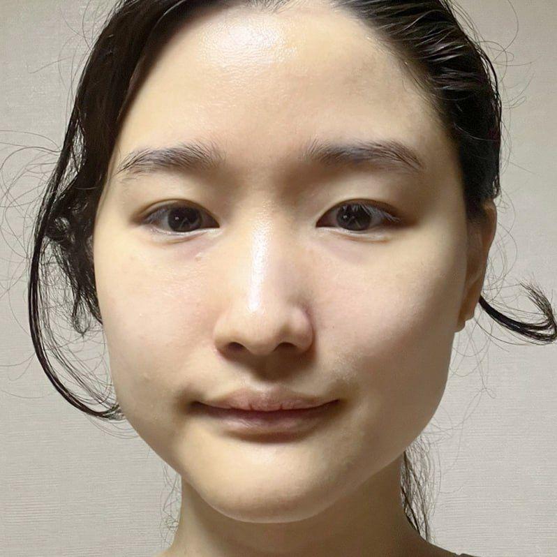 後
