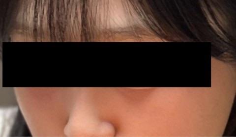 後