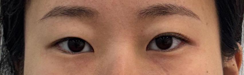 後
