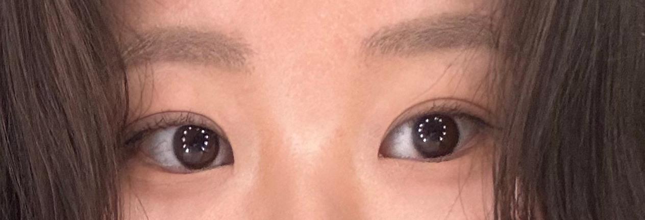 後