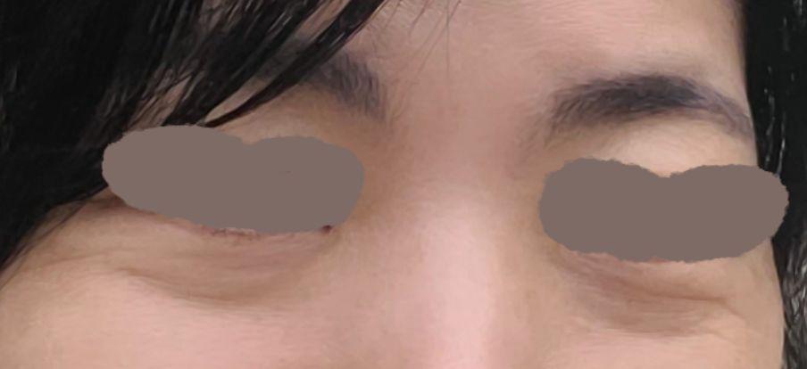 後