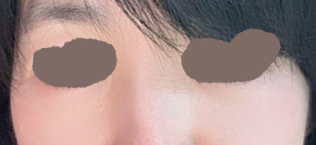 後