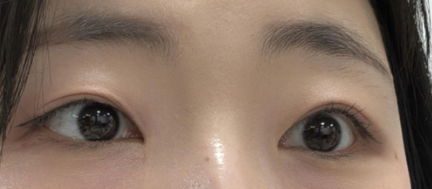 後