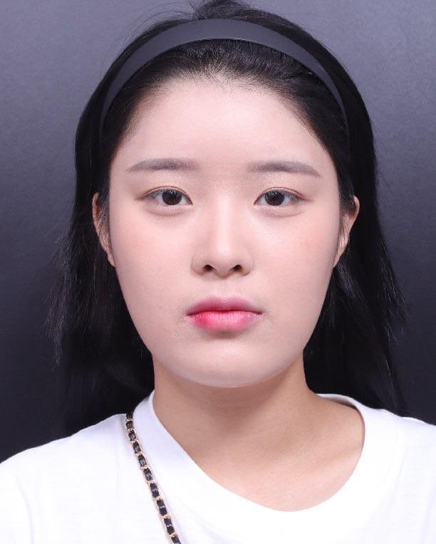 後