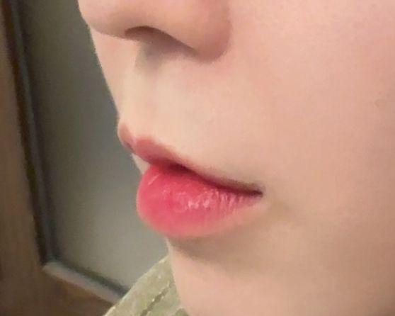 後