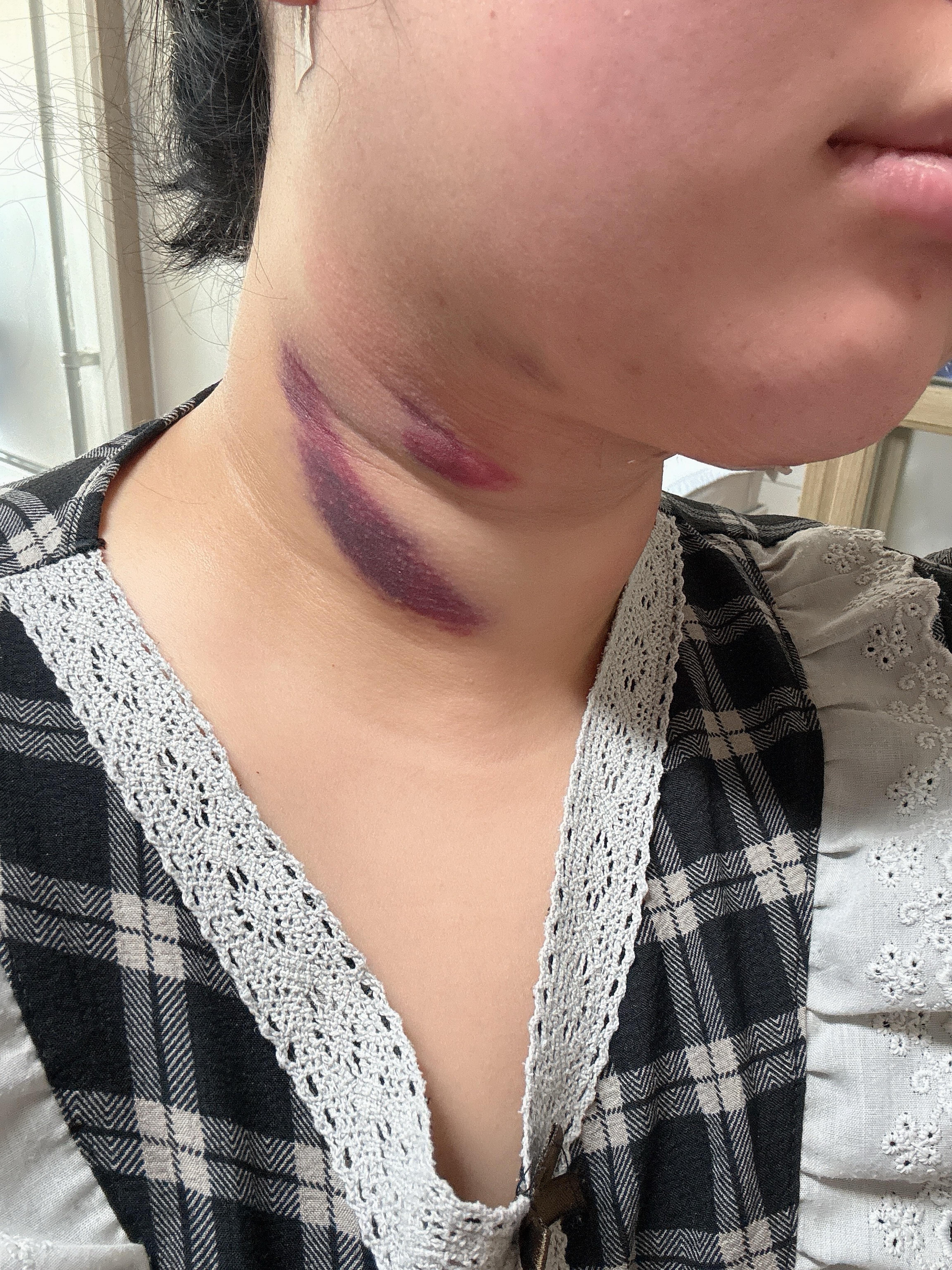後