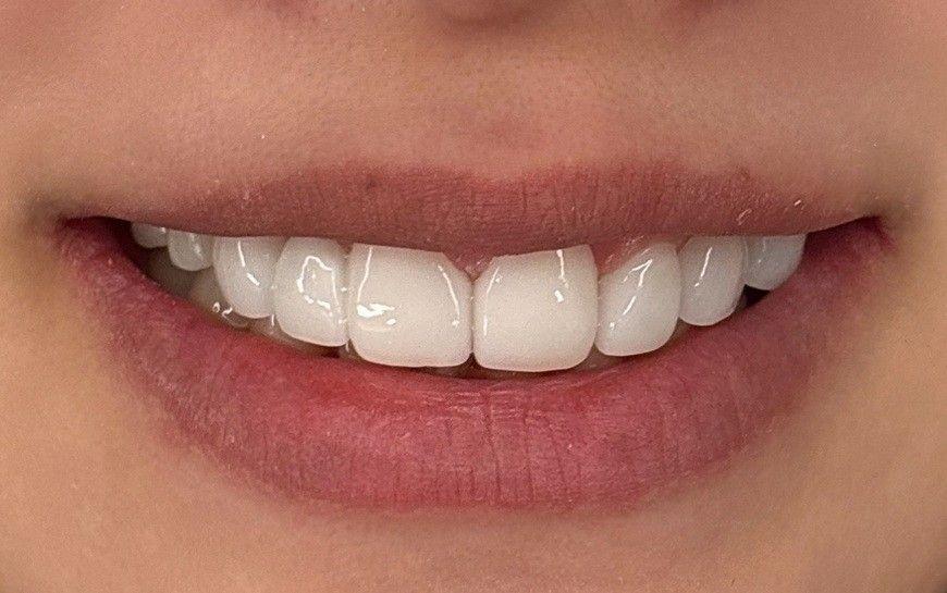 後