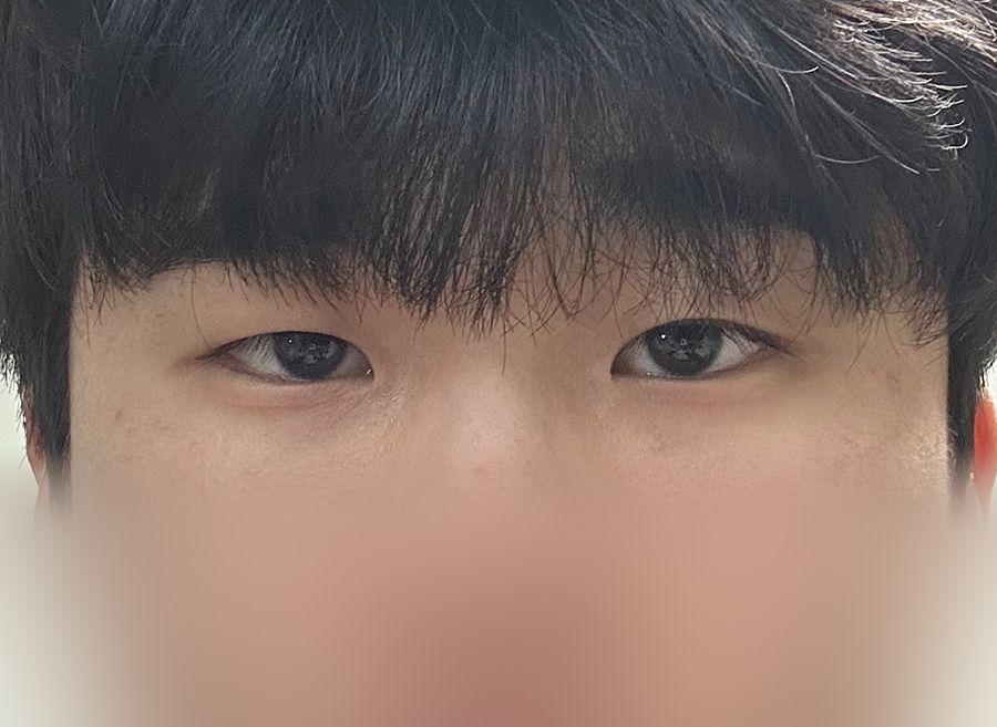 後