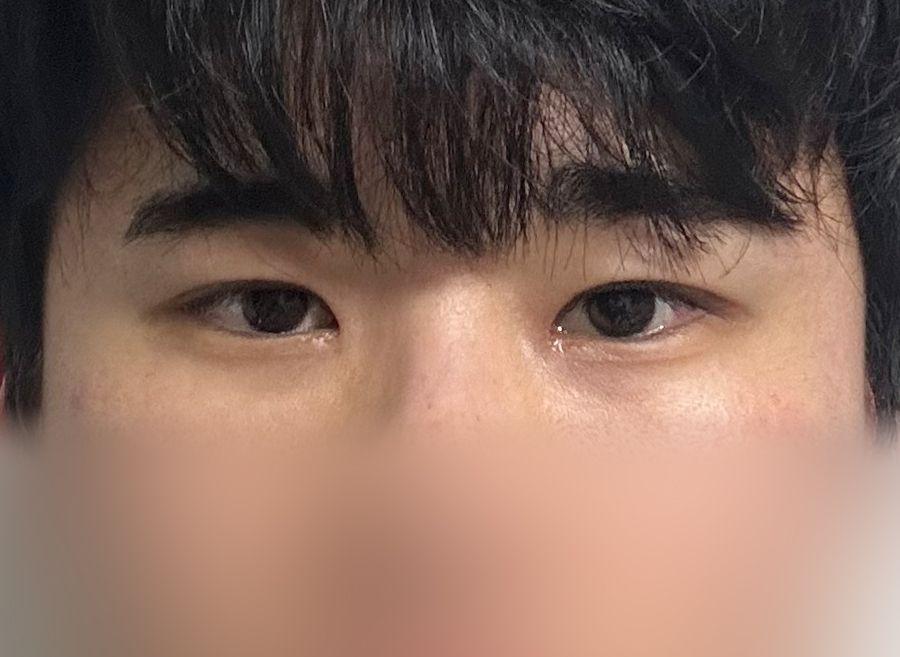 後
