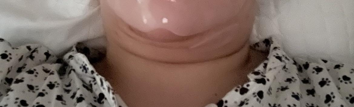 後