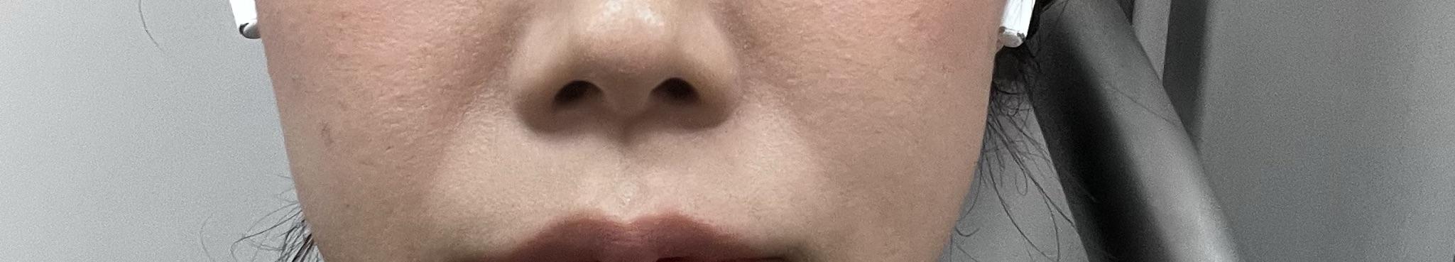 後
