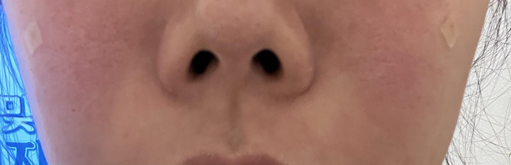 後