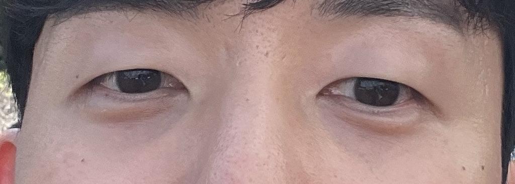 後