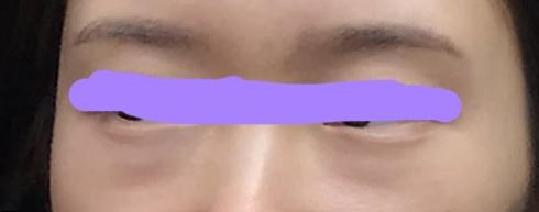 後