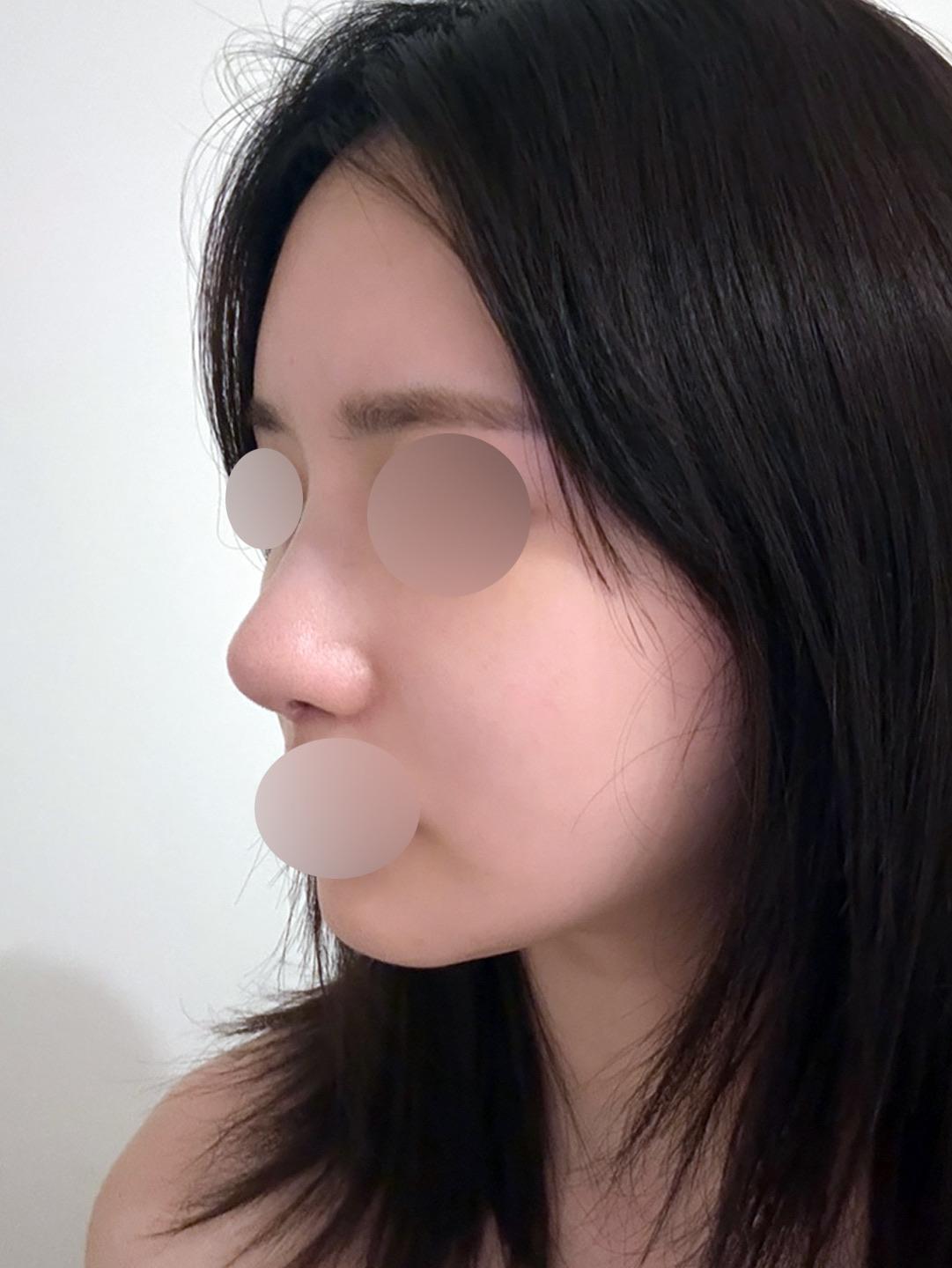 後