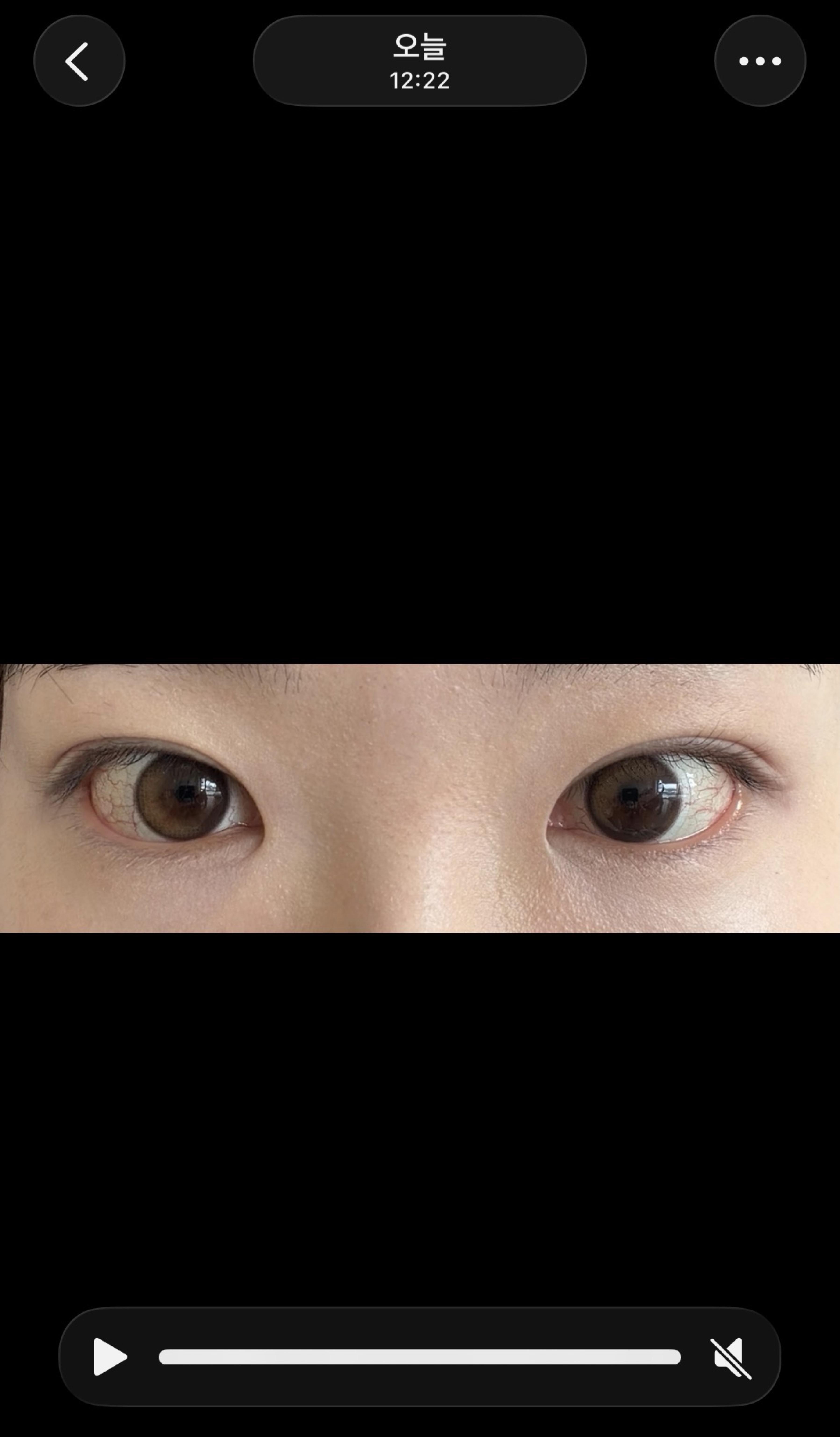 後