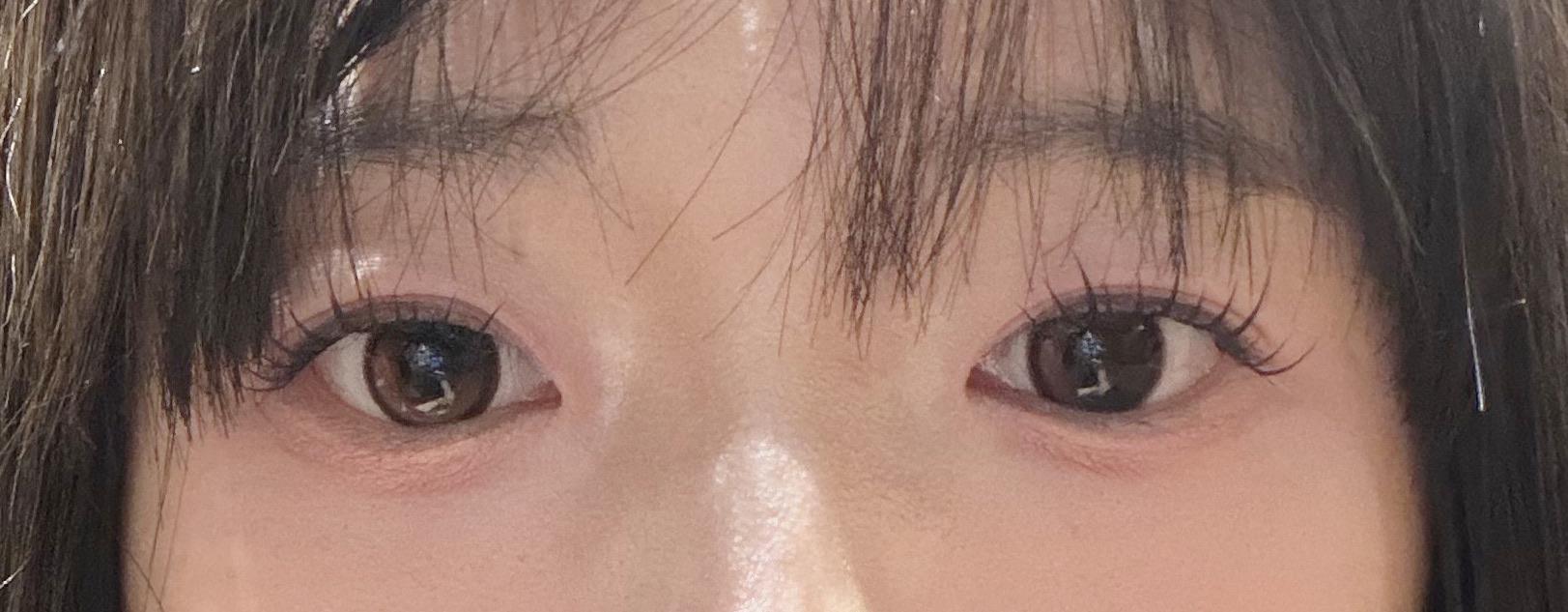 后