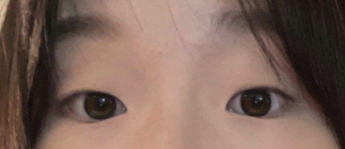 後