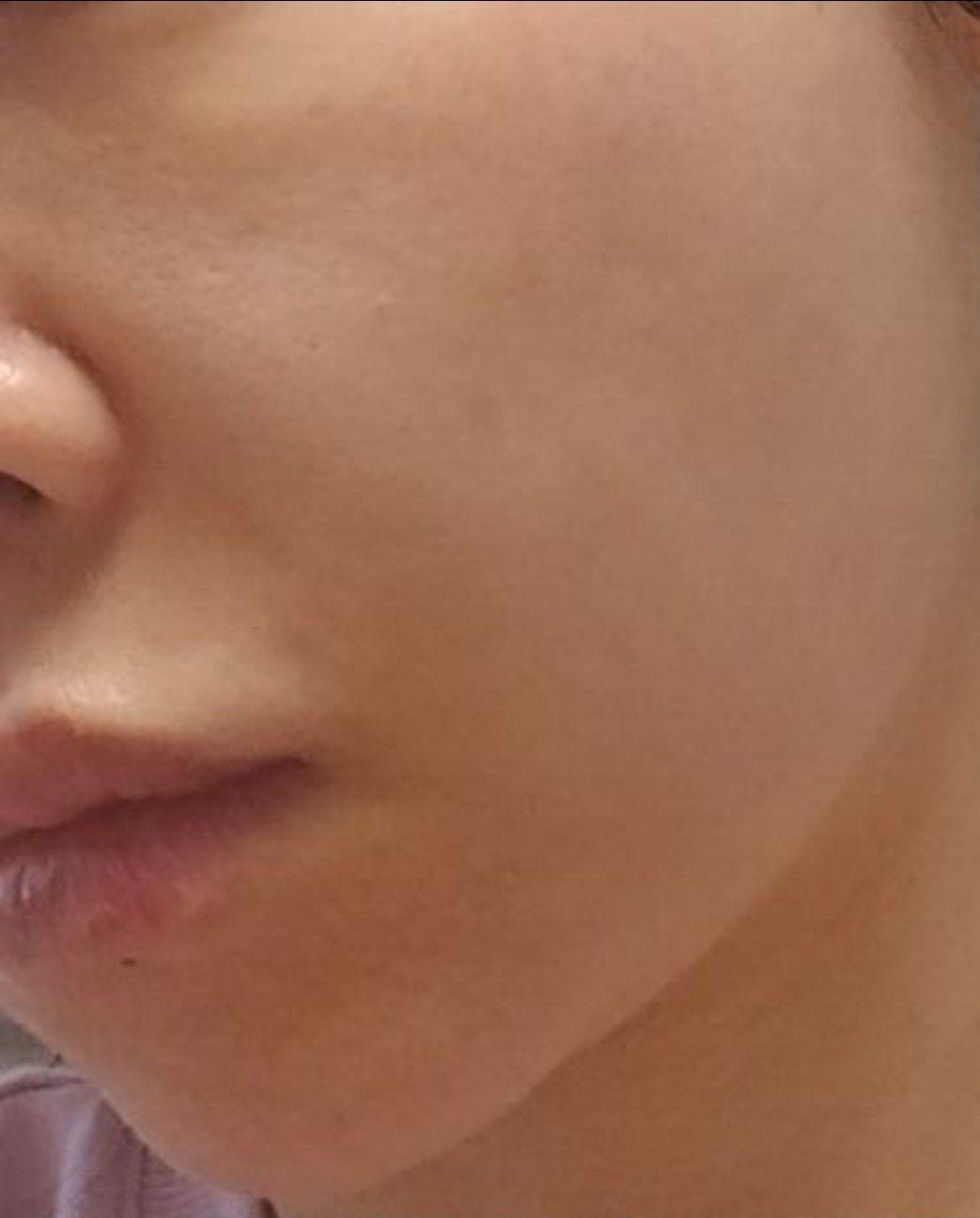 後
