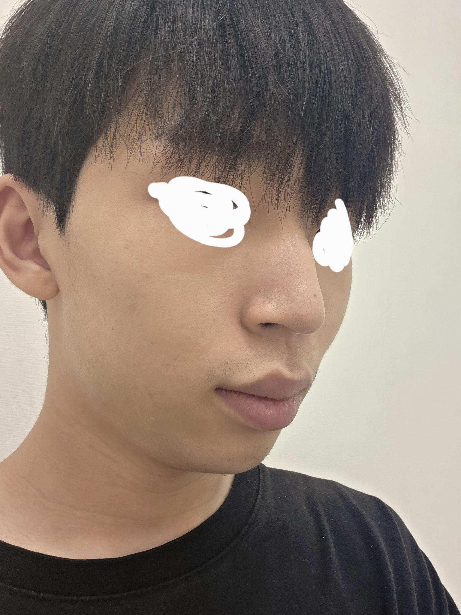 後