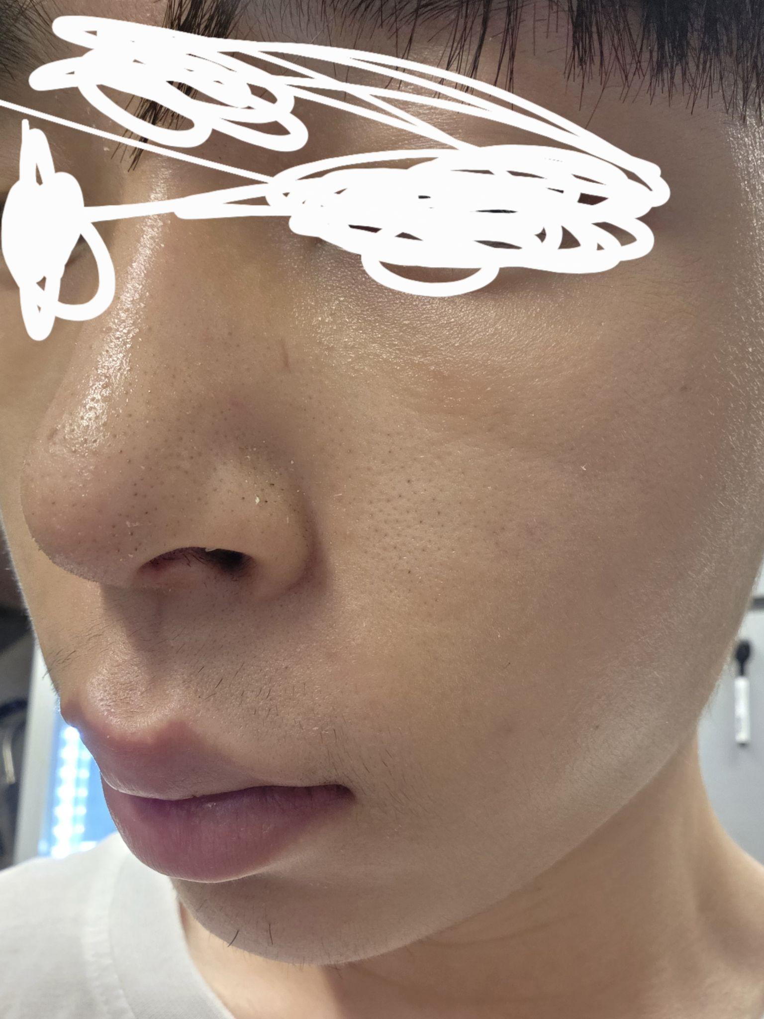 後