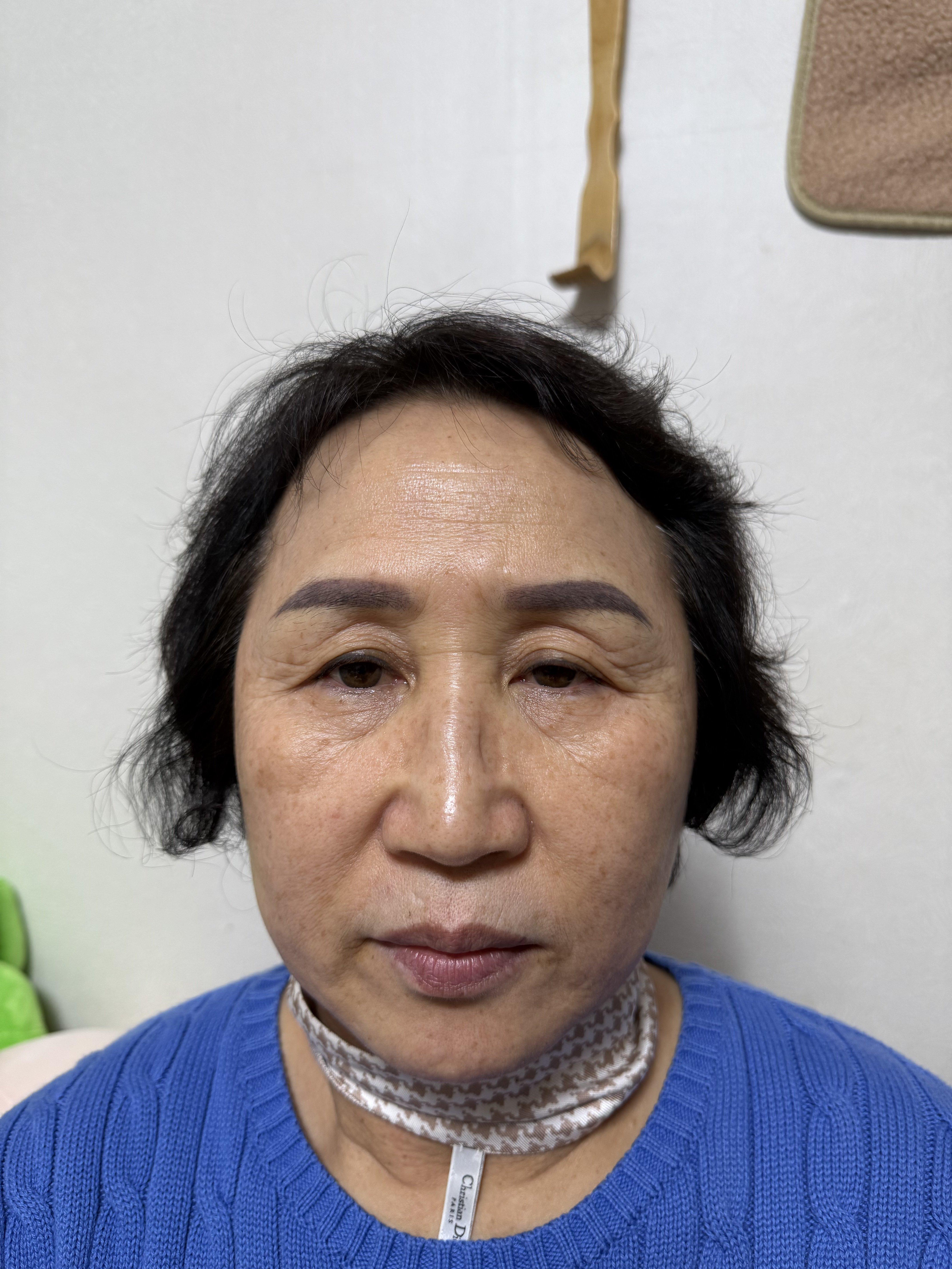 後