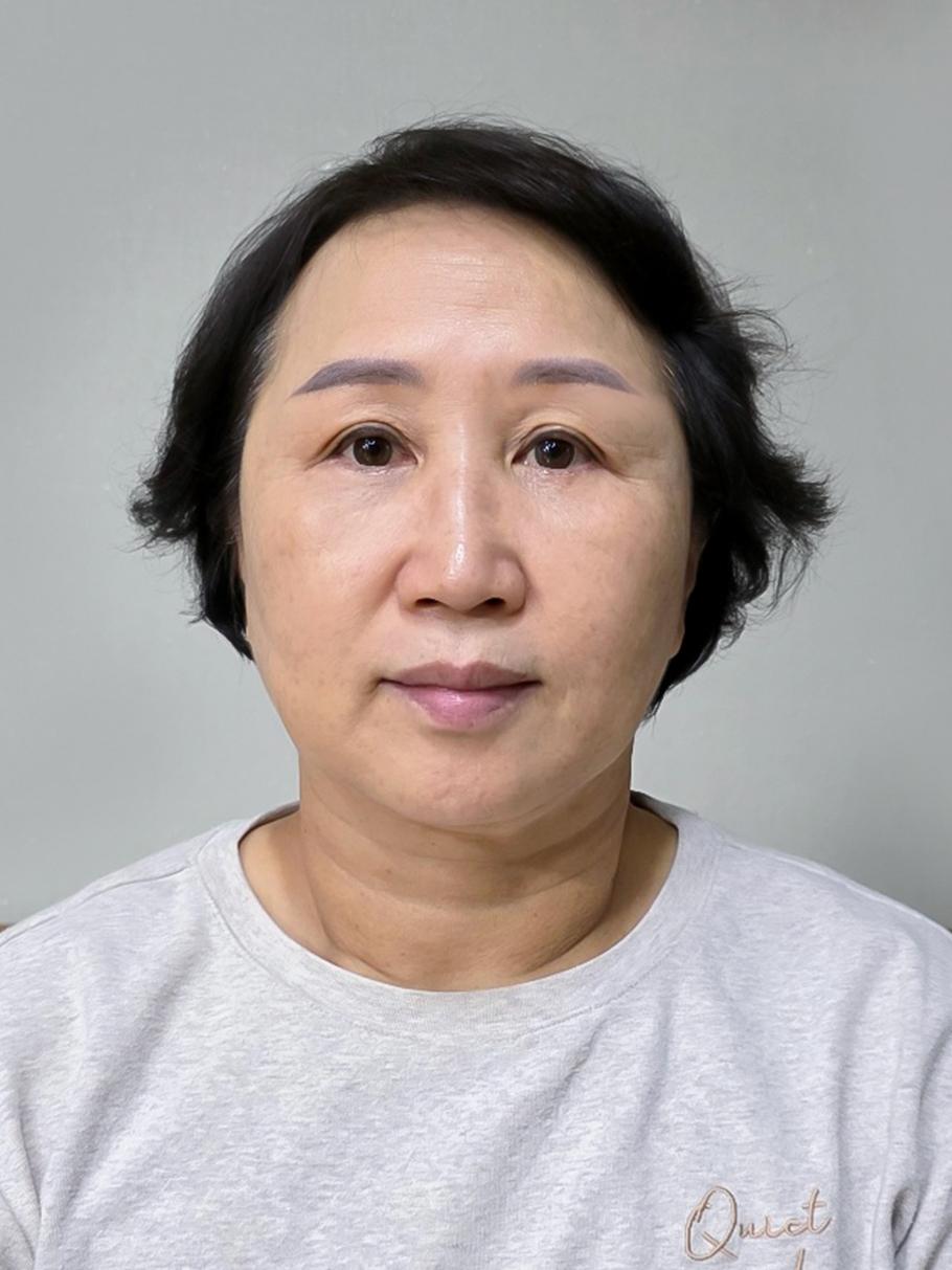 後