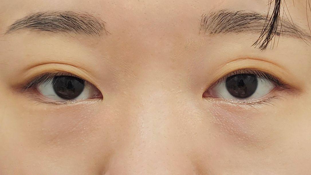 後