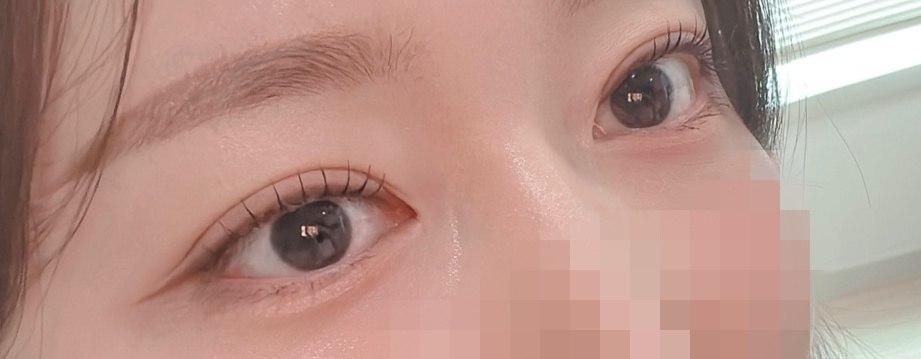 後