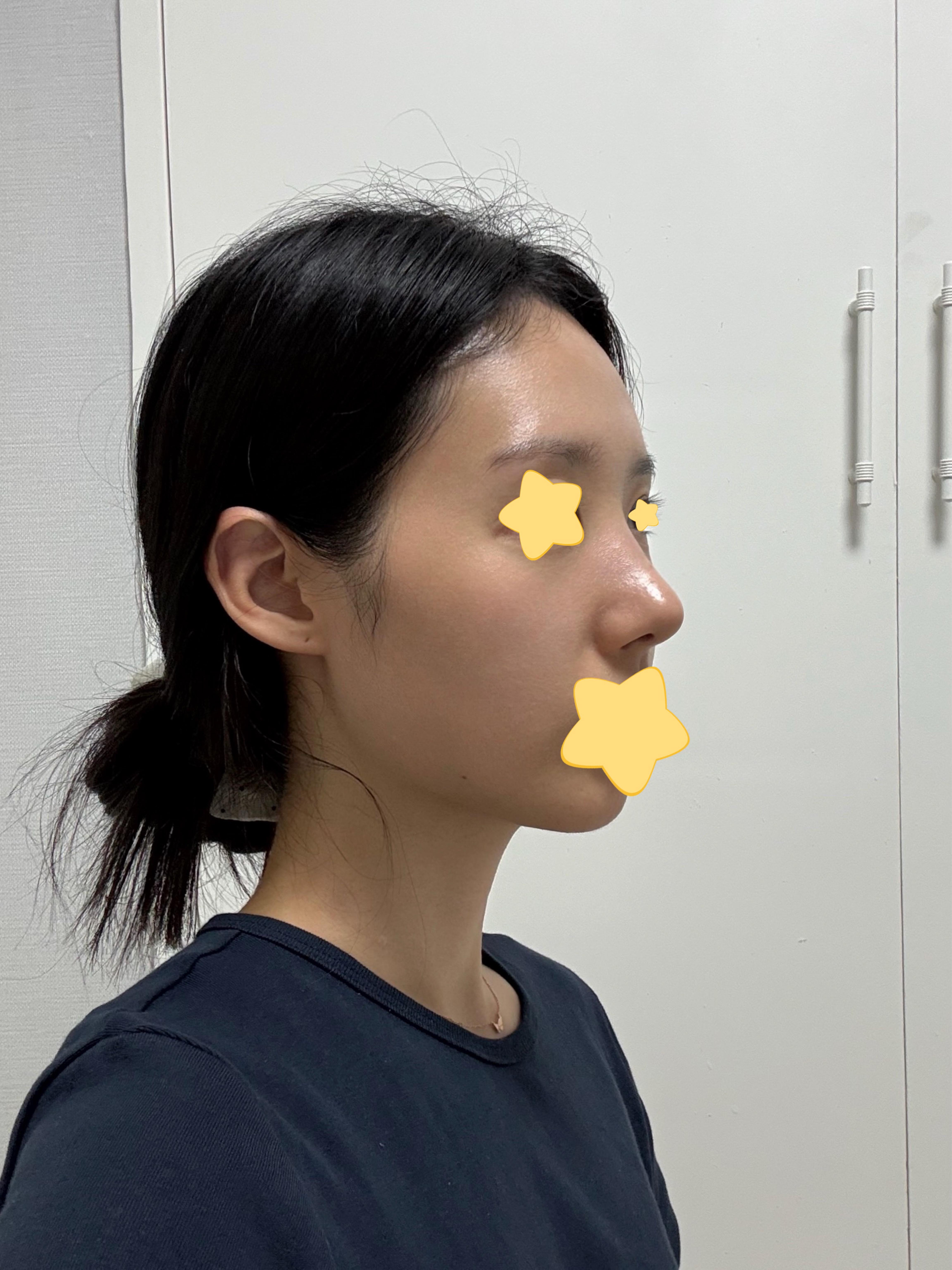 後