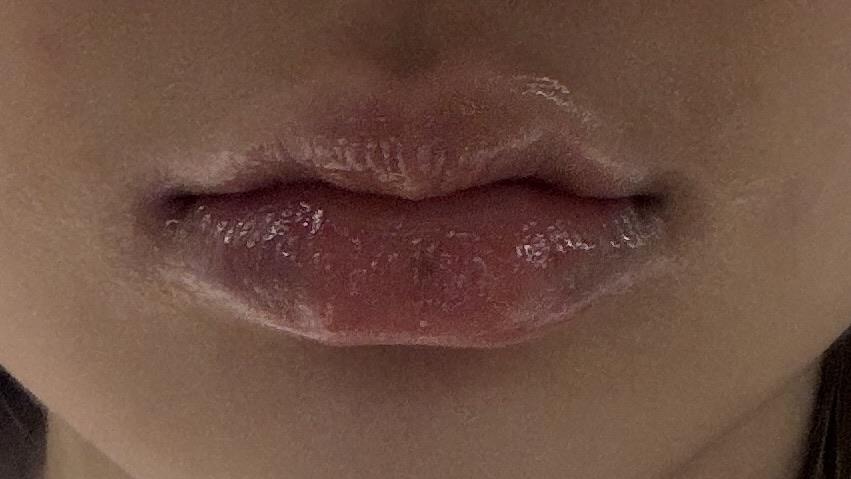 后