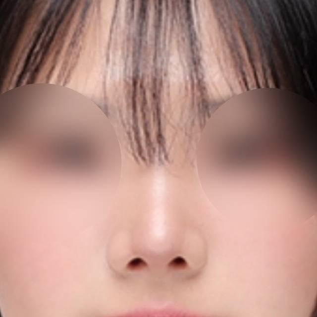 後