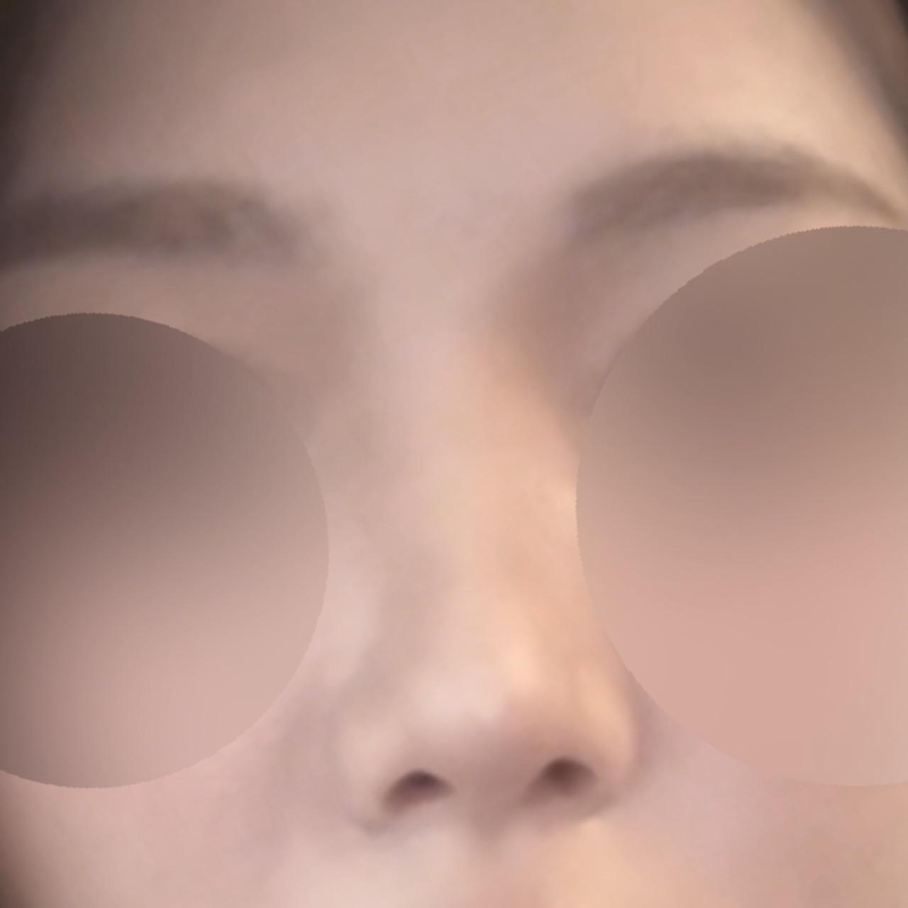後