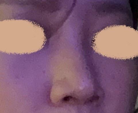 後