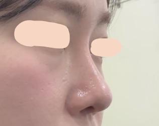 後