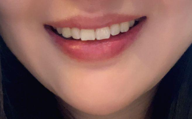 後