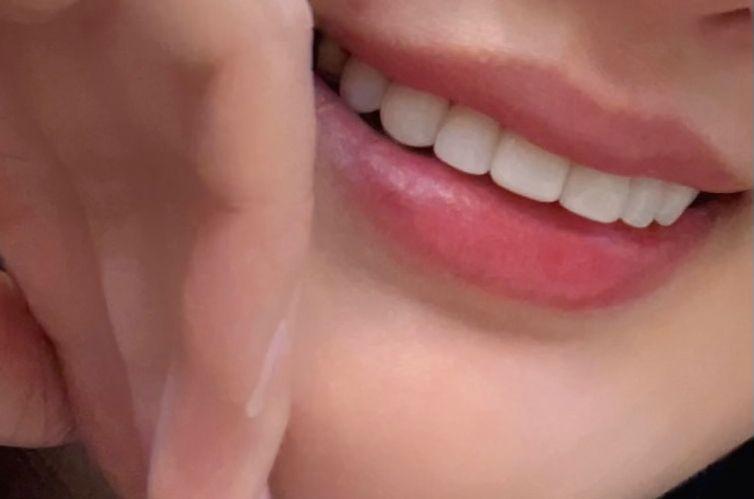 後