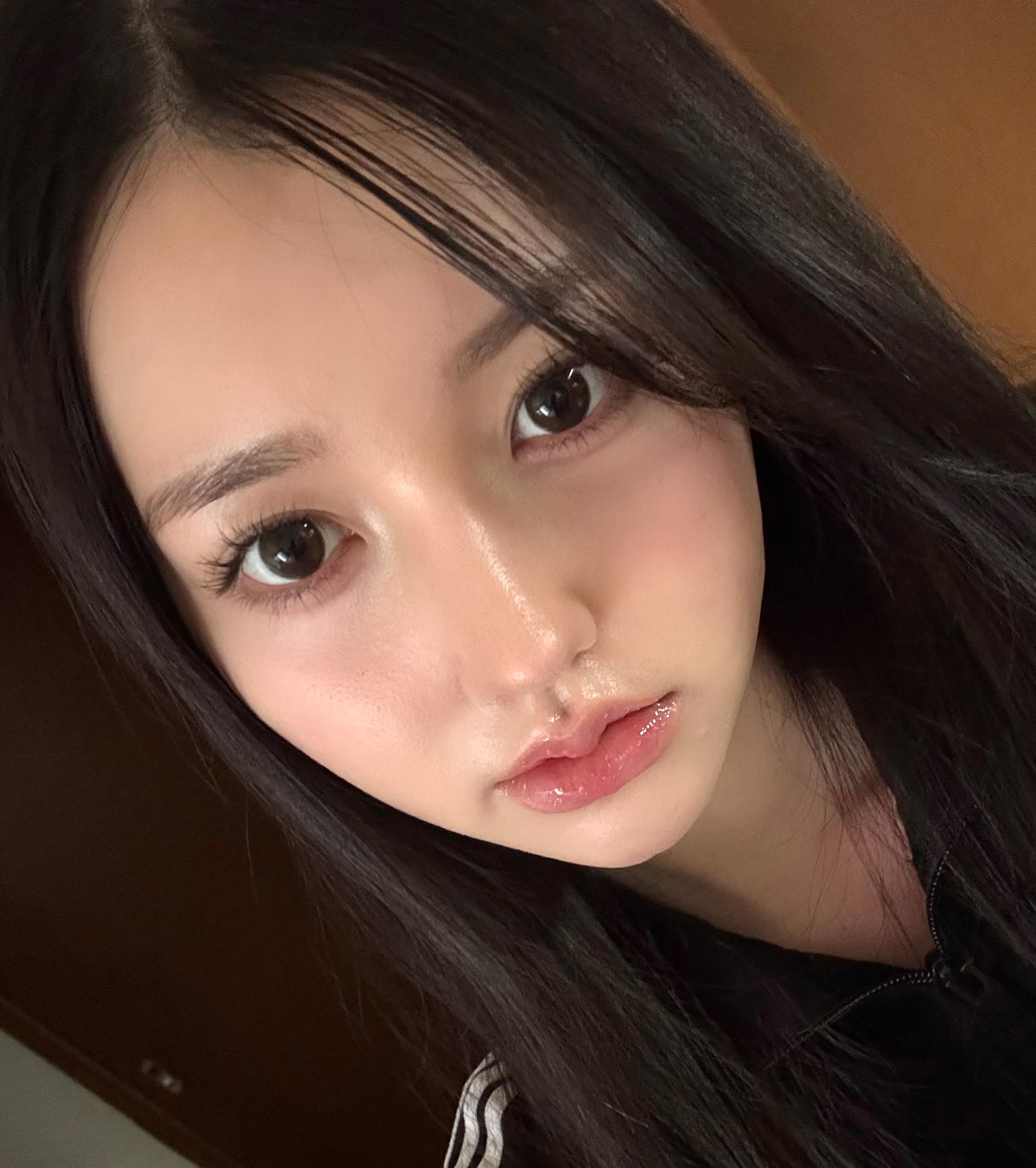 鼻整形といえばOM！ | OM美容外科口コミ | バビトーク, image size:2316x2612