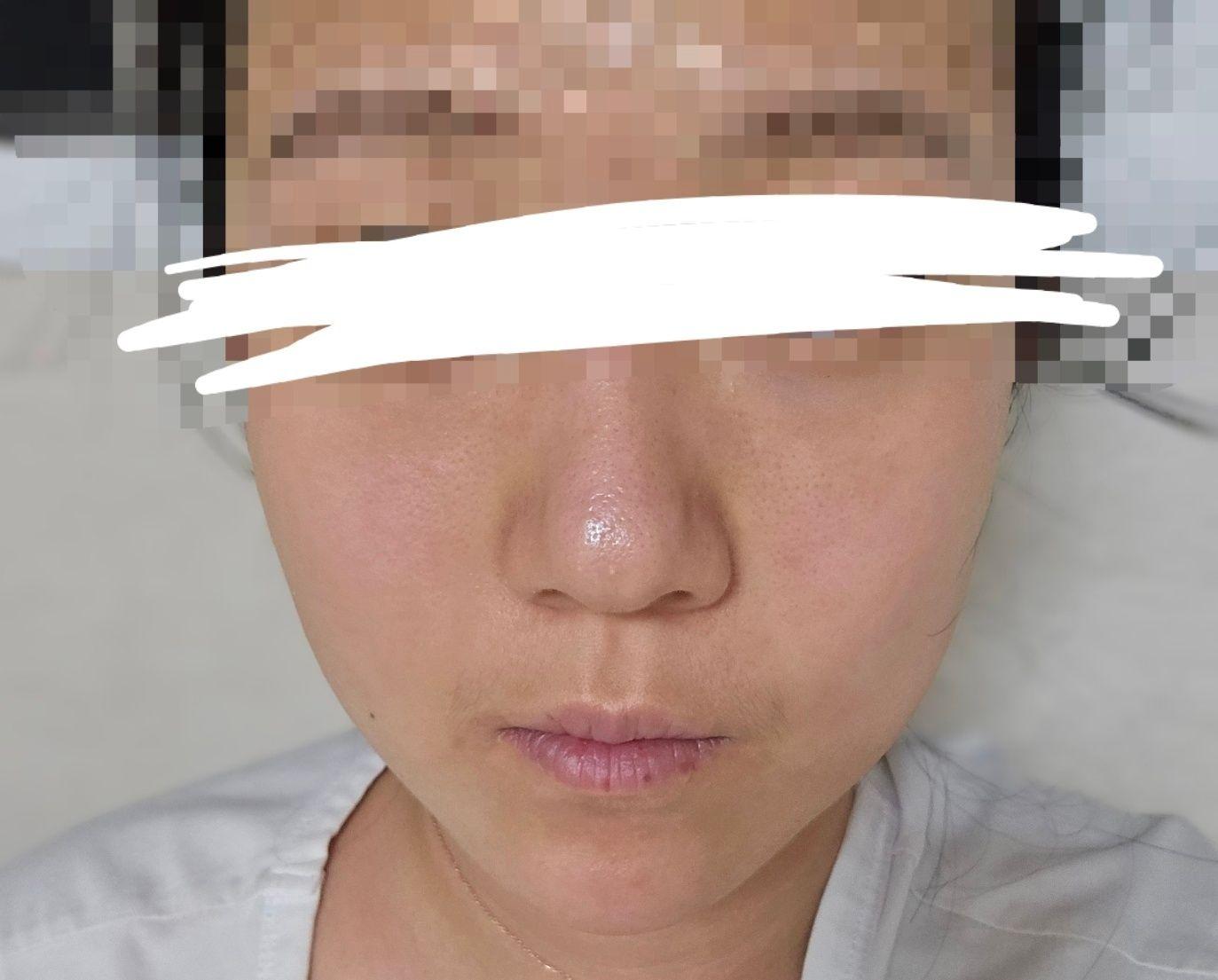 後