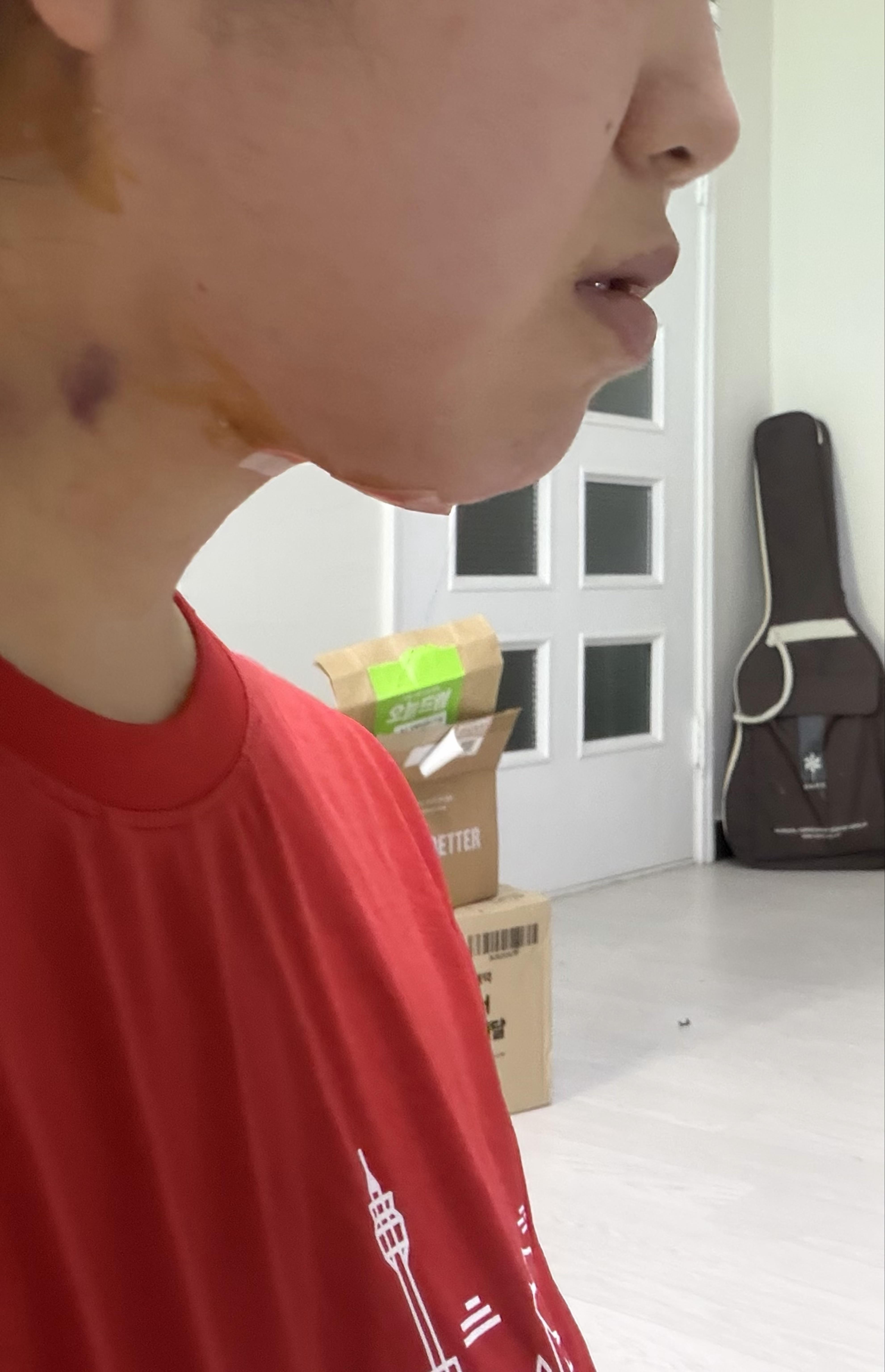 後