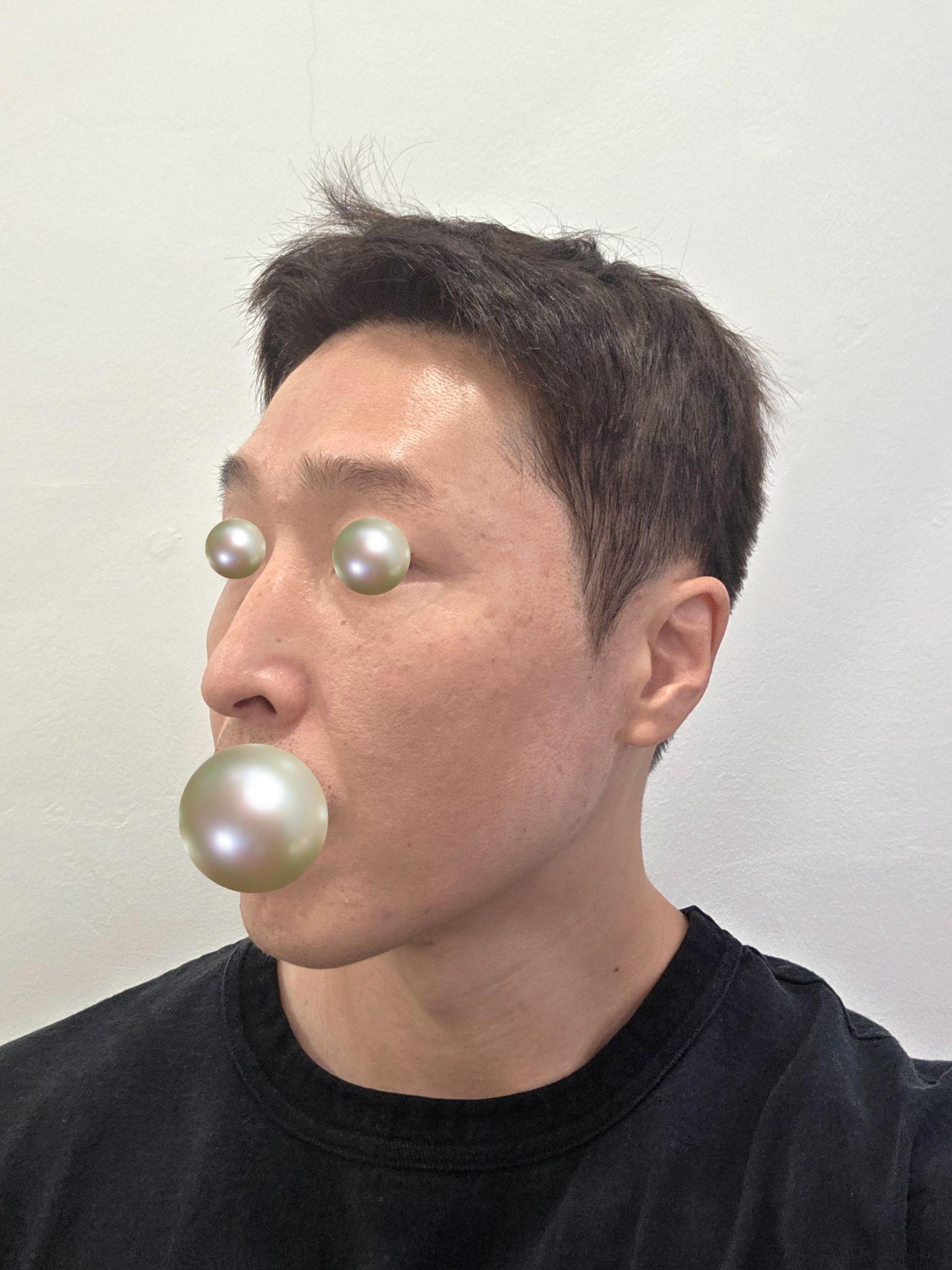 後