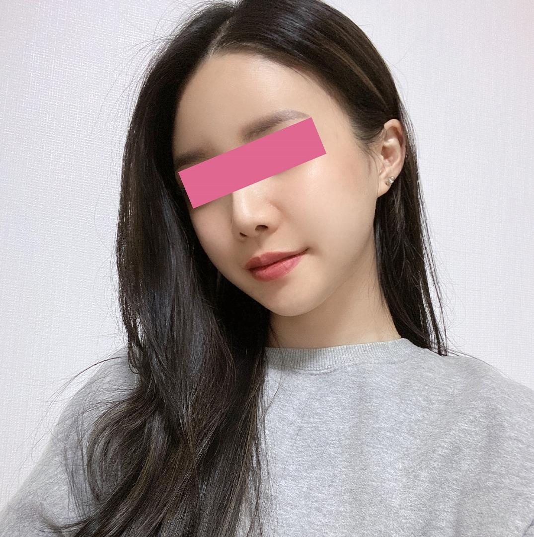 後
