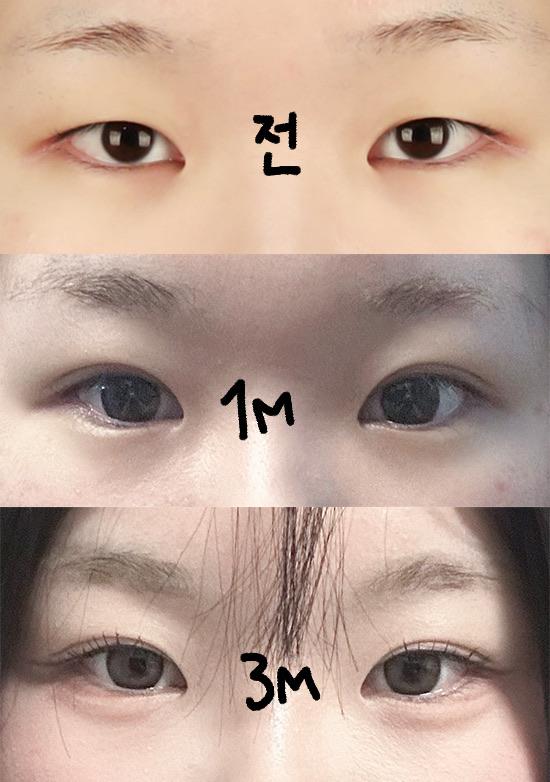 后